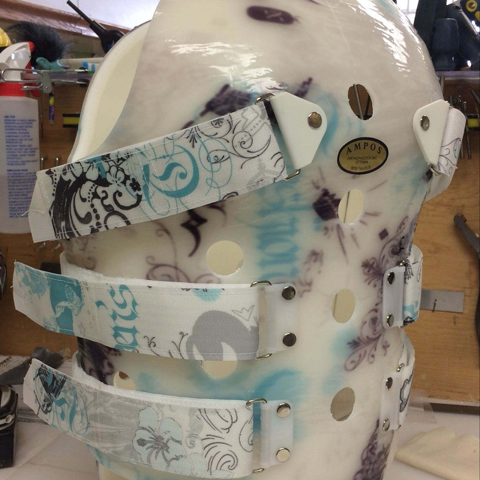 Custom orthotic or prosthetic device