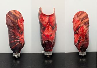 Trans-tibial Prosthesis (below knee) example