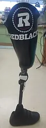 Trans-femoral Prosthesis (above knee) example
