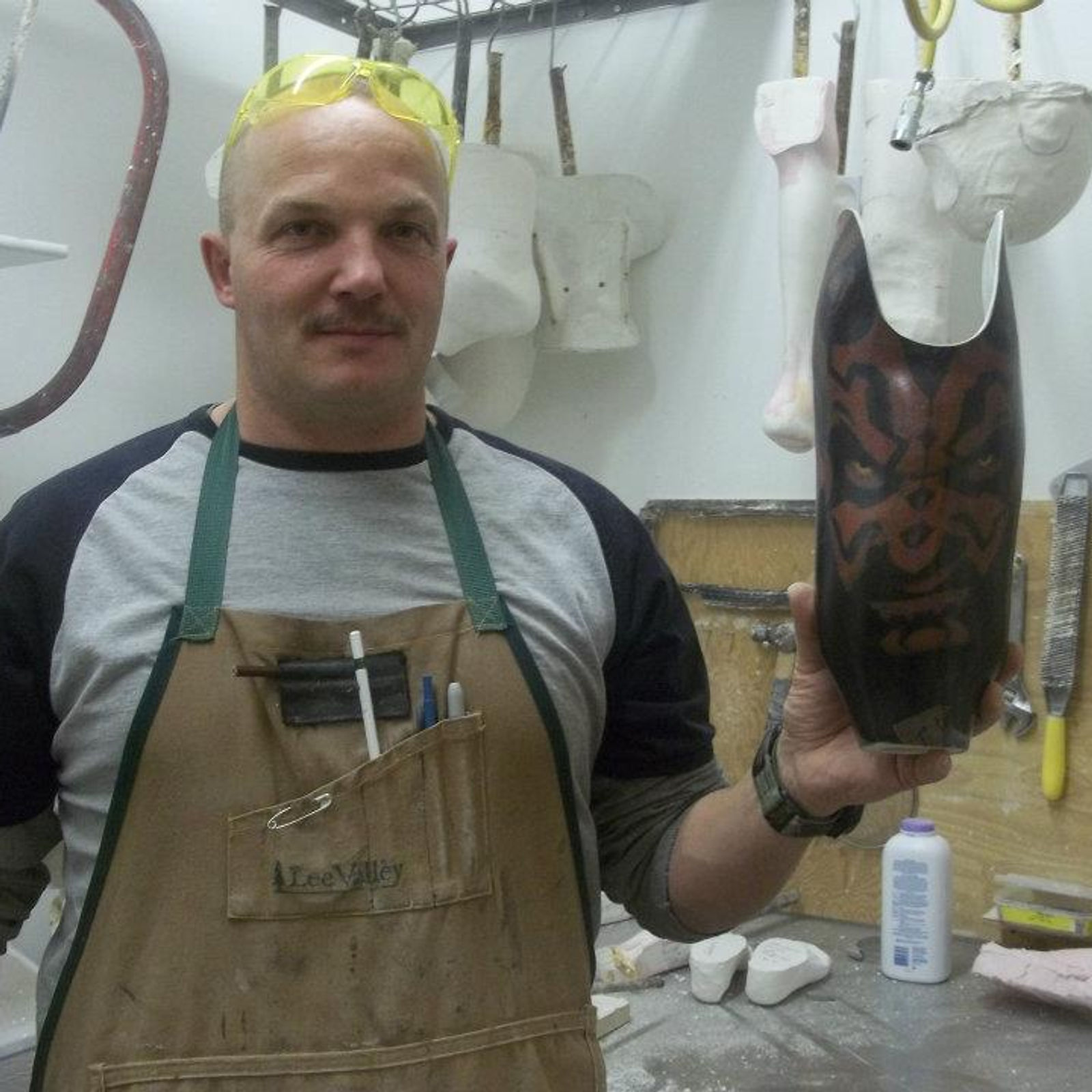 Adrian with a laminated transtibial socket